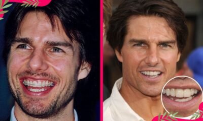 tom cruise teeth