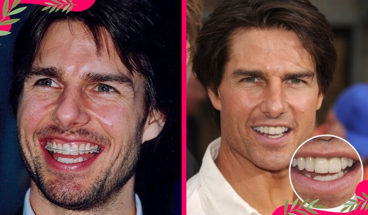 tom cruise teeth